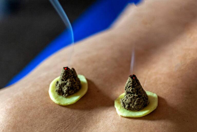 男人排湿气最快的方法(图6) 男人排湿气最快的方法(图6)